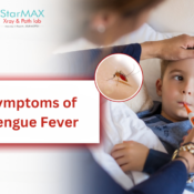 Symptoms of Dengue Fever