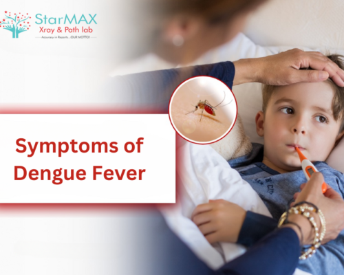 Identifying Early Symptoms of Dengue Fever