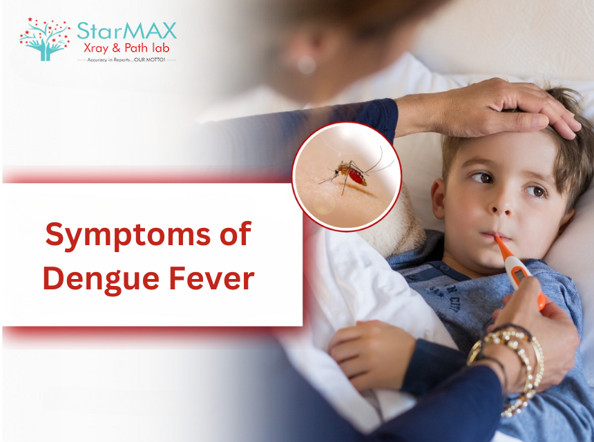 Symptoms of Dengue Fever