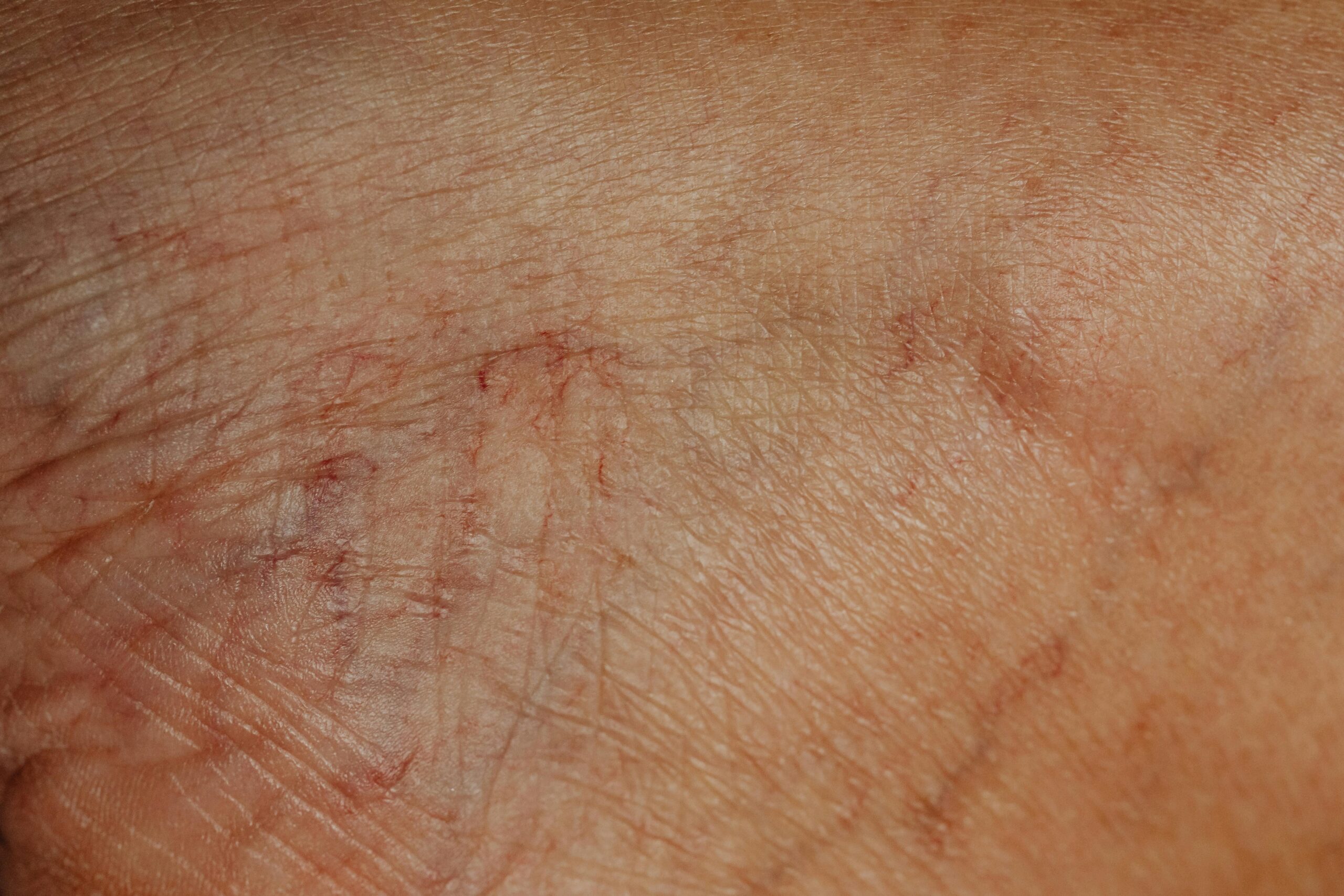 Detailed close-up image highlighting the texture and wrinkles of aging human skin.