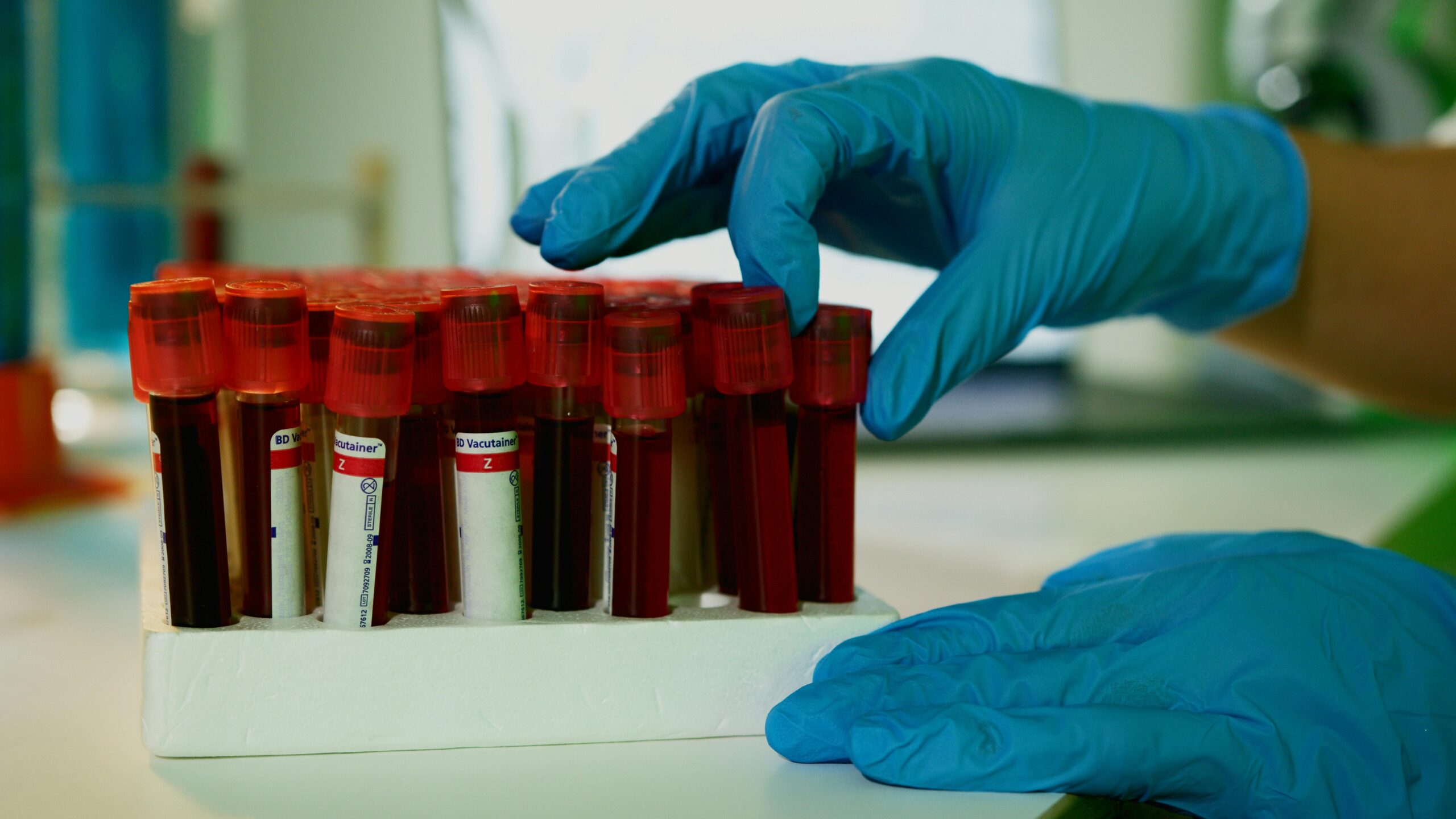A lab technician handles blood vials in a laboratory setting, showcasing medical research.